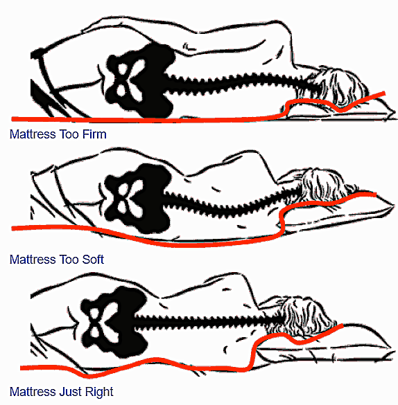 Too soft top mattress back pain